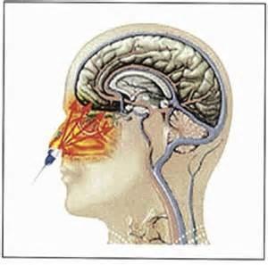 China De Apparaten van de de Lasertherapie van de Rhinitisbehandeling, de Fysieke Machine van de Therapie Lichte Therapie Te koop