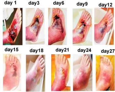 Cina Dispositivo della gestione di dolore da cancro di terapia fisica/dispositivo elettromagnetico di terapia per la gestione di dolore da cancro in vendita