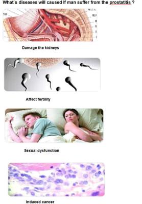 China Máquina no bacteriana crónica física Bioelectric 50Hz - 60Hz de la próstata de la eficacia alta en venta