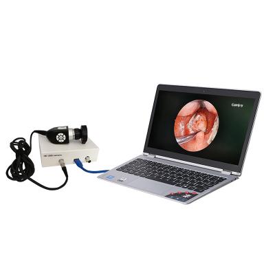 China ENT VETERINARY Endoscopy Endoscope Optical Glass Medical Camera Set Complete for sale