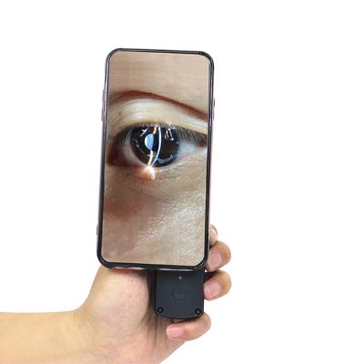 China new portable handheld digital ophthalmic image model S150 slit lamp digital portable slit lamp S150 for sale