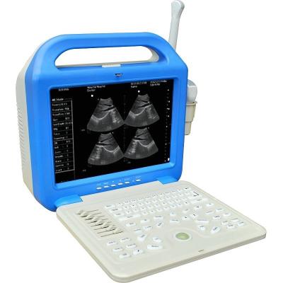 China Digital Laptop Ultrasonic Diagnosis Equipment for sale