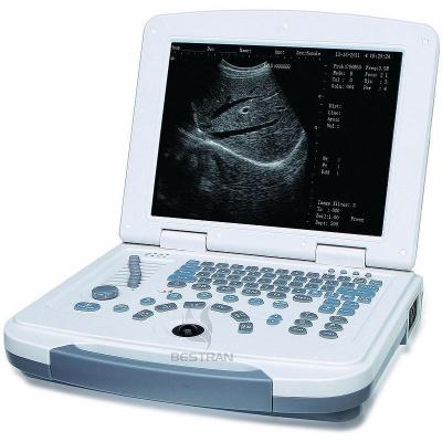 China Laptop Ultrasound Scanner for sale