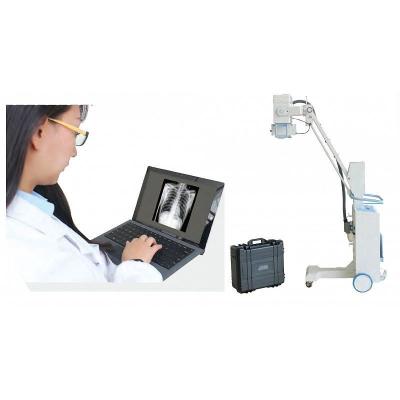 China Digital Mobile X-ray System for sale