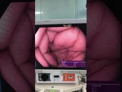 OLYMPUS  CF-HQ190L repair