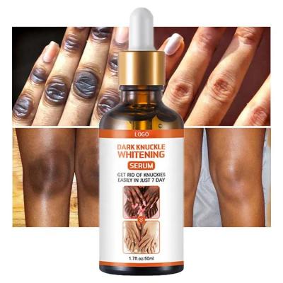 China Custom Black Body Skin Remover Dark Elbow Joint Hand Legs Knees Strong Effective Dark Whitening Serum for sale