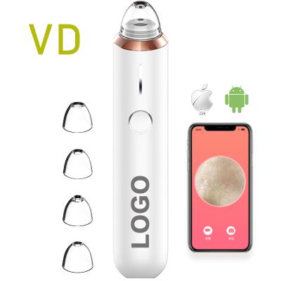 China Acne Removal Blackhead Remover Kit Electric Vacuum Pore Remover Suction Primer Blackhead Extractor Tool for sale