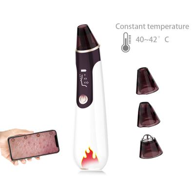 China Hot Black Head Removal Compress WLAN Link Function Derma Suction Vacuum Blackhead Remover for sale