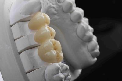 Cina alta trasmissione di biossido di zirconio 3D di pendenza naturale dentaria a più strati del blocchetto in vendita