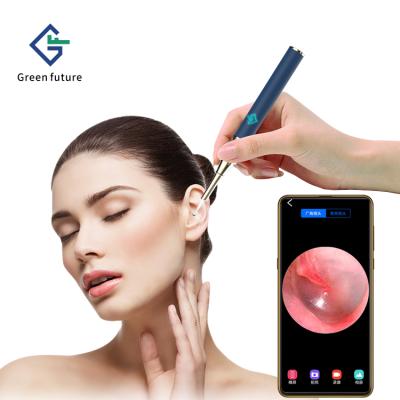 China Magnet Cover Switch GF Ear Wax Remover Visual Automatic Ear Pick Remover With 3 Axis Gyroscope for sale