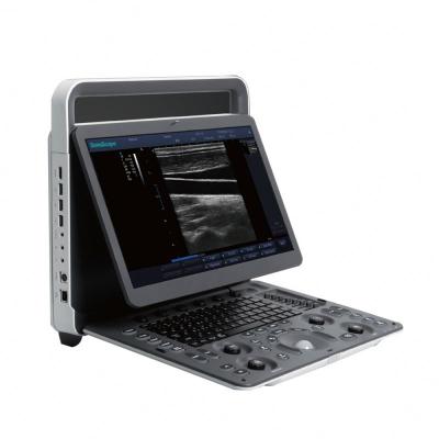 China Plastic Portable B/W Ultrasound Machine Sonoscape E1Ultrasound System Machine for sale