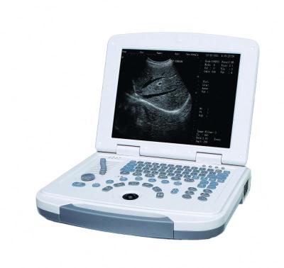 China GYN Laptop B&W Ultrasound CD-580 for sale