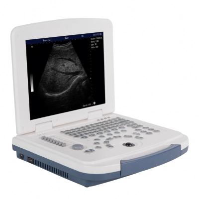 China HBW-4 Full Metal Laptop Digital B/W Ultra Sound Machine For Pregnancy for sale