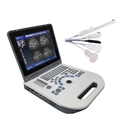 China HBW-3 Metal Plus Full Digital Laptop B/W Ultrasound Machine for sale