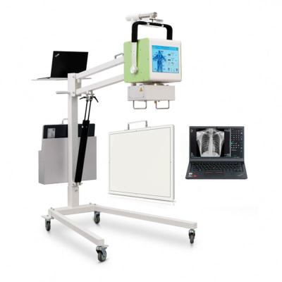 China Mobile Metal Radiology Equipment Hospital X-Ray Machine 5KW/100mA Portable X-Ray Machine for sale