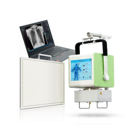 China X-ray room. X-ray service | Mobile Digit Medical X Ray Equipments 5kW Digital Hospital Portable Medical DR Xray Panel for sale