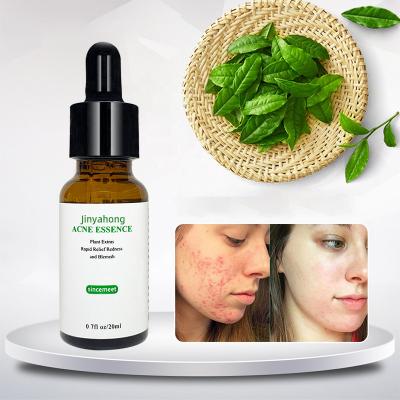 China Herbal Acne Treatment Private Label Skin Care Anti Aging Serum Treatment Acne Pimple Remover Serum for sale