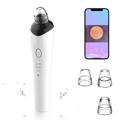 China Mini 20x HD Beauty Equipment Suction Blackhead Remover Vacuum Acne Treatment Anthracnose for sale