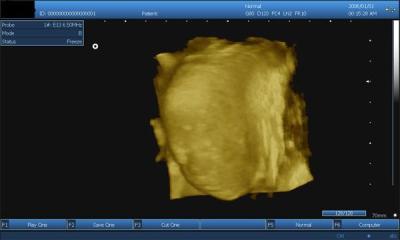 China SV-9 15 inch PC Based Laptop 3D Ultrasound Scanner with one 3.5 Mhz convex probe for sale