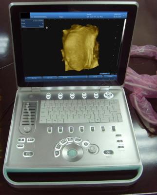 China SV-9 15 inch PC Based Laptop 3D Ultrasound Scanner with one 3.5 Mhz convex probe for sale