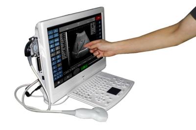 China SV-U8 Portable 3.5 Mhz convex probe Touch screen ultrasound scanner with 3D function optional for sale