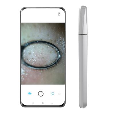 China Hot Newest Style Smart Visible Pore Cleaning Instrument, Acne Smart Visible Needle, Intelligent Visible Pore Remover 12.5*12.5*140mm for sale