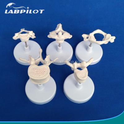 China Vivid Vertebra Models for Medical Science Atlas Axis Cervical Thoracic and Lumbar for sale