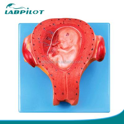 China Advanced PVC Item Pregnant Embryo Model Third Month Uterus with Umbilical Cord Model for sale