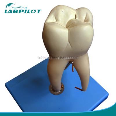 Chine Dentiste démonstration de soins Détachable modèle anatomique des dents pour les dents molaires à trois racines à vendre