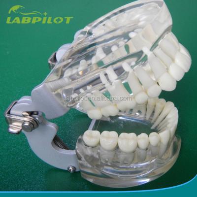 Chine Modèles de formation en dentisterie adultes standard transparents Colonne dentaire modèle taille standard à vendre