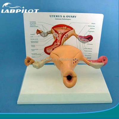 China Advanced PVC Human Uterus and Ovary Model for Women's Reproductive System Education for sale