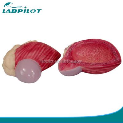 China Advanced PVC Human Male Urinary Bladder Anatomical Model for Medical Professionals for sale