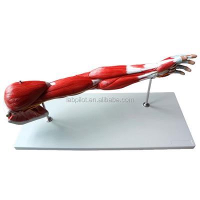 China Detachable Arm Muscles Vascular and Neural Model for Upper Limb Motor System Anatomy for sale