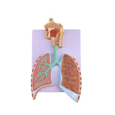 Chine Modèle avancé d'anatomie pulmonaire en PVC pour une démonstration précise du système respiratoire à vendre