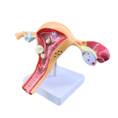 China Female Internal and External Genital Organs Model Medical Science for Human Life Size for sale