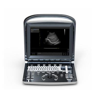 China Portable Metal 4D/3D Doppler Heart Scan Ultrasound Therapeutic Gynecological Machine with Printer for sale