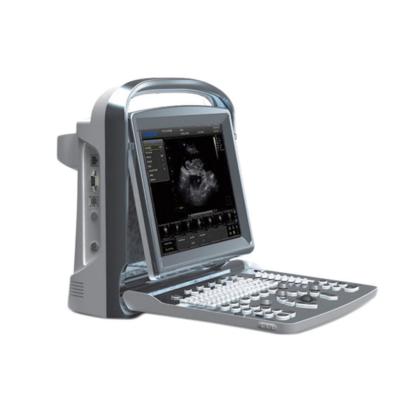 China Direct Metal Medical 4D / 3D Treatment Doppler Heart Scan Gynecological Ultrasound Machine With Printer for sale