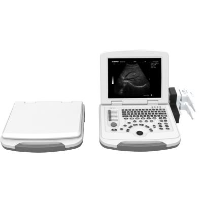 China Full Digital Fashion Metal Hospital Ultrasound Equipment Ultrasound Scanner Portable Ultrasound for sale