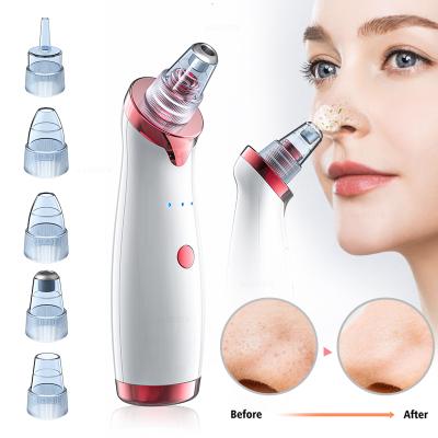 China Hot Sale Electric Acne Treatment Blackhead Beauty Clean Device 5 In 1 Black Spot Remover Head Vacuum for sale