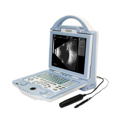 중국 High Resolution Dog Ultrasound Scanner LCD Screen Ophthalmic For Ophthalmolog 판매용