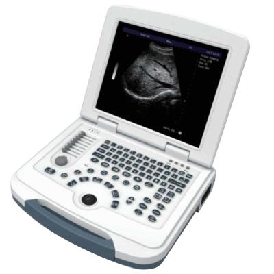 중국 Full Digital Wireless Ultrasound Machine Operating Room Supplies For Human 판매용