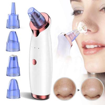 China Electric Blackhead Remover Vacuum Pore Remover Vacuum Acne Dots Remover Facial Acne Treatment Suction Pore Remover for sale