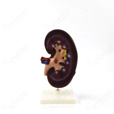 China School And Hospital Enlarged PVC 3D Anatomical Advanced Human Kidney Model for sale