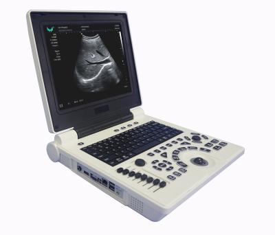 China Purchase Ultrasonic Machine P20 Metal Notebook Diagnostic System Portable 3D Ultrasound Scanner for sale