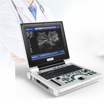 China Handheld Metal Notebook LED Digital Ultrasound Scanner for sale