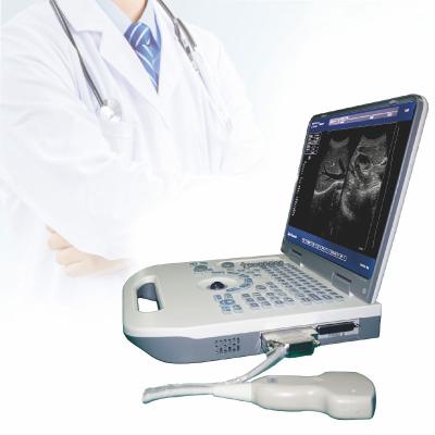 China Metal LED Digital Ultrasound Medical Instruments Notebook Handheld Ultrasound Scanner for sale