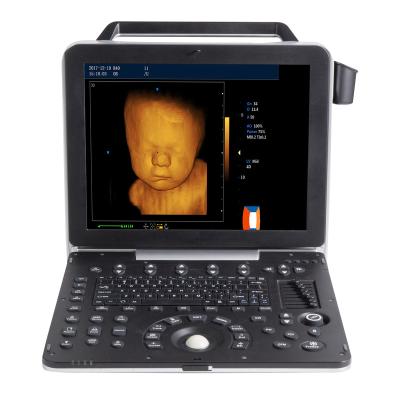 China Universal 3D 4D Color 15 Inch LED Acrylic Portable Screen 4G Memory Medical Tabletop Ultrasound Machine for sale