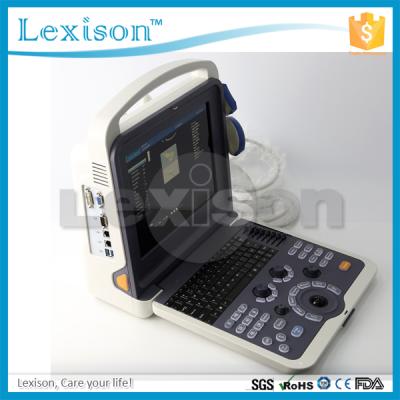 China Cardiac Portable 4D Ultrasound Scanner Color Doppler Ultrasound Machine Price 59 x 57 x 40 cm / 31 kg for sale