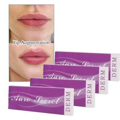 China Derm 1ml 2ml Filler Lip Enlargement Dermal Filler Injection for sale