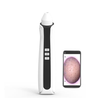 China Acne Treatment Phone Linked Display WiFi Visual Suction Pore Vacuum Blackhead Remover With Camera for sale